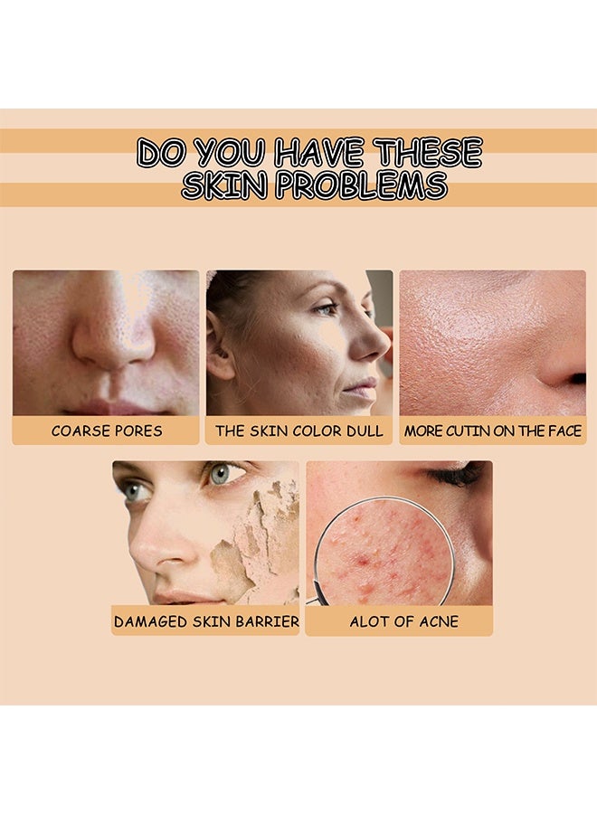 أوهو سيروم نياكيناميد، 10% نياكيناميد 8% NAG – مصحح البقع الداكنة، معزز الترطيب ومراقبة الدهون، مدعم بالجليسرين لبشرة مشرقة، لجميع أنواع البشرة، العناية بالبشرة الكورية، 30 مل - Image 5