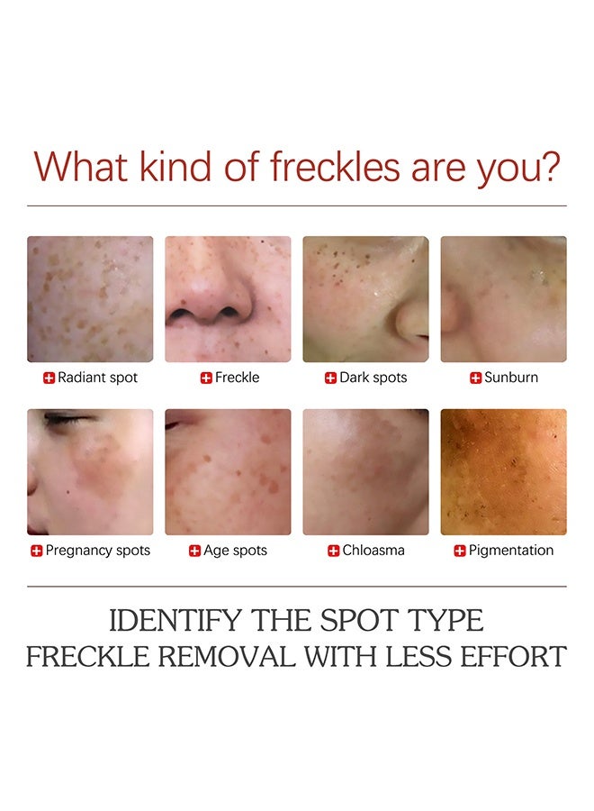 EELHOE Pigment Correcting Cream, Freckles Removal Cream Pigment Correcting Serum Remove Melasma Age Spots Sunspots Whitening Freckle Removing Cream Effective Brightening Essence Remove Pigment Melanin 30g - Image 3