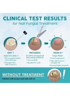 Ebanel Fungus Master, Antifungal Treatment, 1.0 fl.oz  - Image 5
