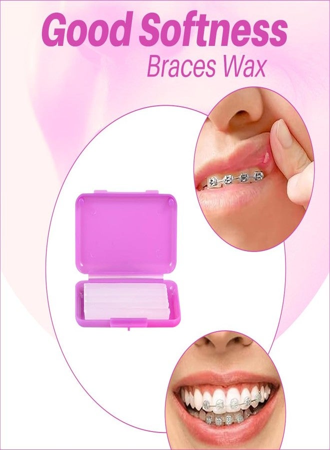 Dentosmile (Strawberry Flavored Orthodontic Wax For Braces/Patient Relief Wax Dental Wax For Braces Support Wax To Relieve Irritation And Pain - 5 Strips Per Box (4 - Image 2