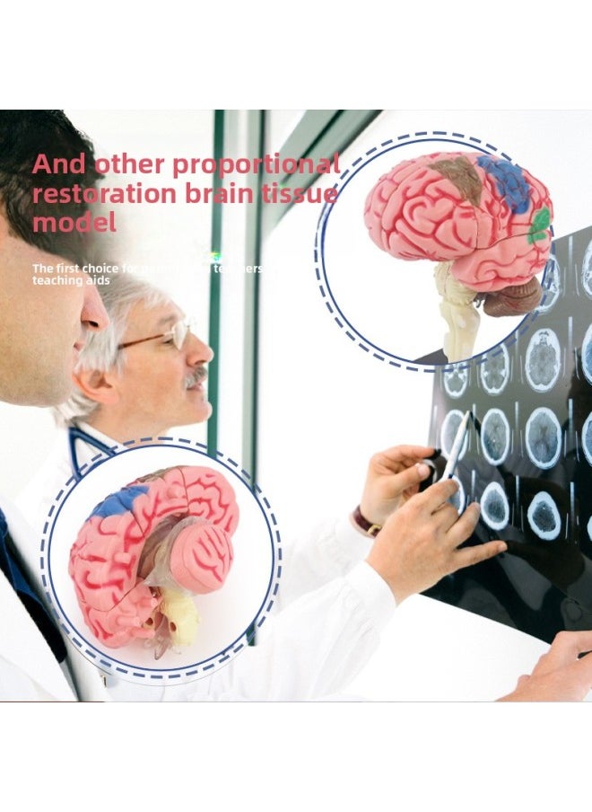 null - Human Brain Model Human Brain Nerve Brainstem Structure Teaching Appliance Cerebrovascular Distribution Brain Function DIY Toys-Color:Human Body Series [eye Ball Model] - Image 1