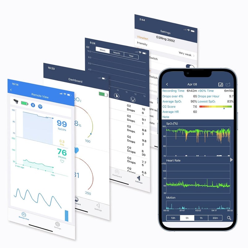 ViATOM Checkme O2 Sleep Pulse Oximeter Blood Oxygen Monitor Finger and Wrist with Bluetooth Wearable Sleep Monitor with Continuous Monitoring Professional APPPC Report - Image 5