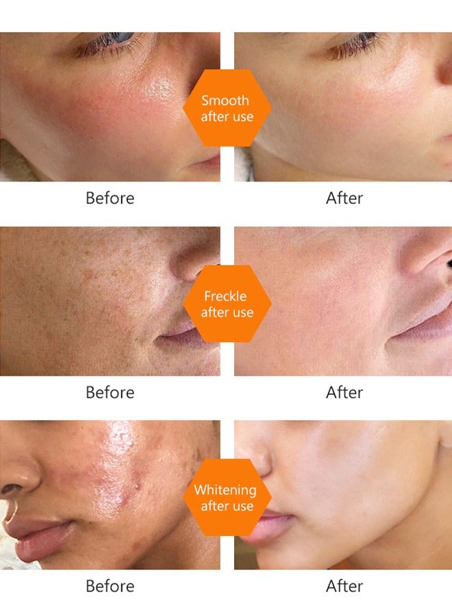 EELHOE Turmeric Toner Dark Spots Eraser-Corrector Toner 100ML Facial Toner For Acne Prone Skin Dark Spot Remover For Face Hydrating Face Toner For Women Treatment  - Image 3