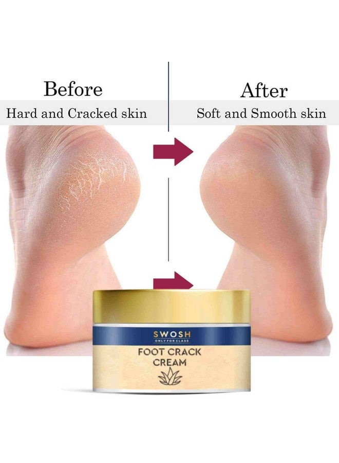 SWOSH Foot Cream For Dry And Cracked Feet 50 G (Pack Of 2) | Foot Crack Remover, Cracked Heel Repair Cream For Winter | Moisturizes And Soothes Feet (100 G) - Image 5