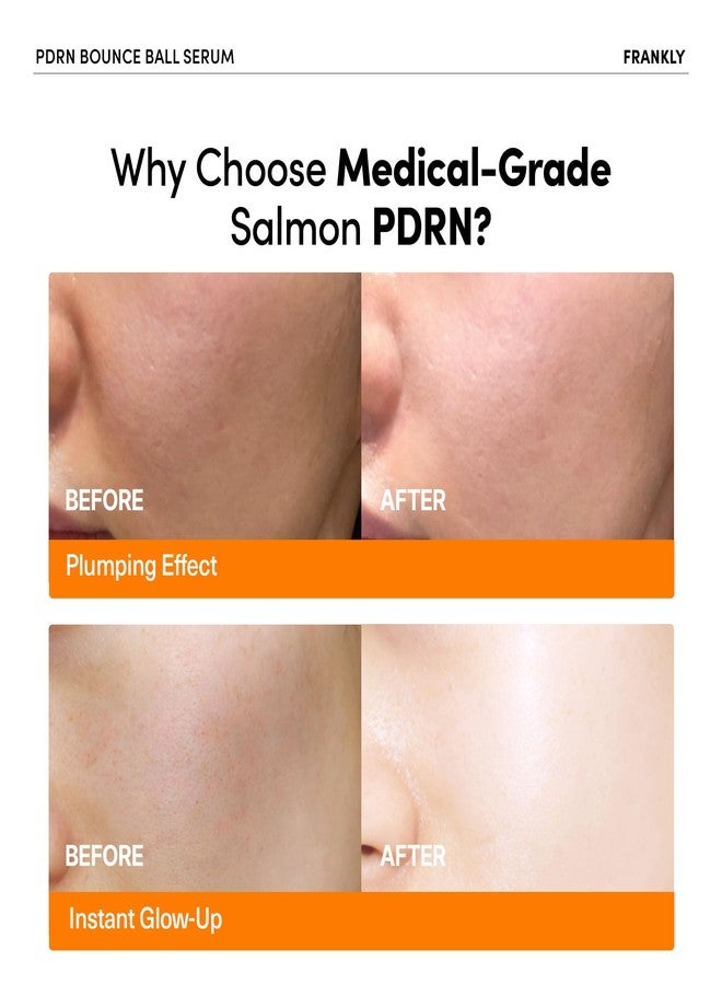 FRANKLY PDRN Bounce Ball Serum - PDRN Salmon DNA Serum for Plumping, Firming & Glass Skin | Glowing skin Booster | Lightweight, Non-Sticky Korean Skincare | 1.01 fl oz - Image 2