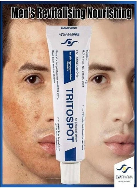 Tritospot Tropical Cream For Hyperpigmentation Problems for Men and Women