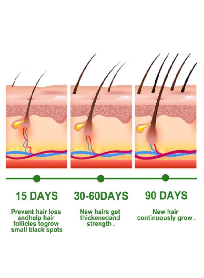 EELHOE Rosemary Hair Care Essential Oil promotes hair growth and reduces hair breakage & loss - Image 4