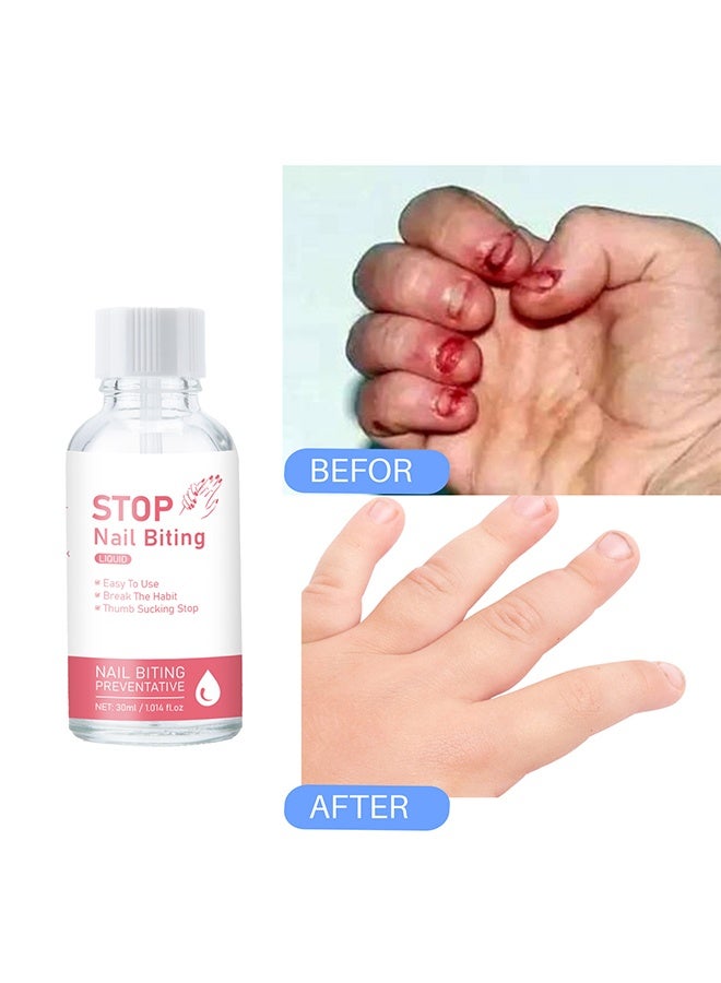 SAUVASINE Stop Nail Biting Liquid，Nail Biting Treatment for Kids, Natural Thumb Sucking Pain Relief for Kids, Bitters, Plant Extracts 30ml - Image 4