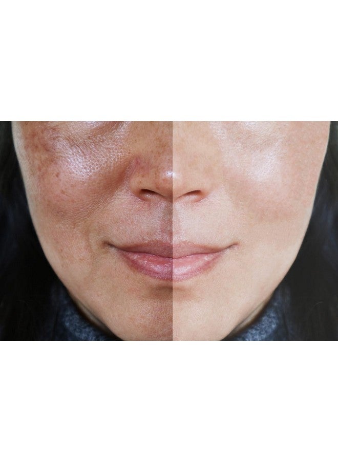 Precision Skin RX Vitality Precision Skin Phloretin C Serum - Image 2