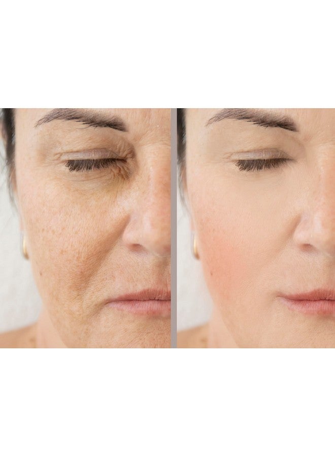 Precision Skin RX Vitality Precision Skin Phloretin C Serum - Image 4