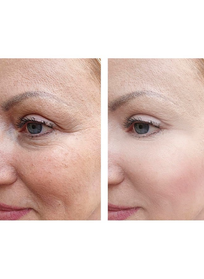 Precision Skin RX Vitality Precision Skin Phloretin C Serum - Image 3