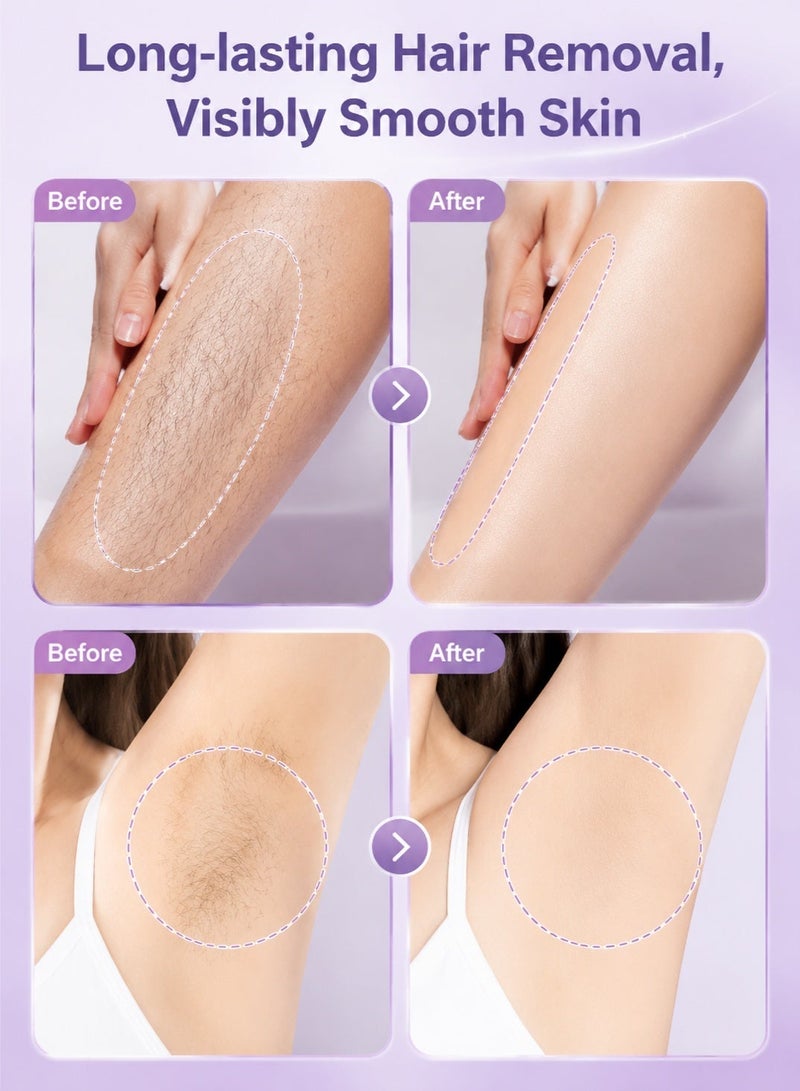 Woofixer Ice Cooling Laser Hair Removal Device, Upgraded High Energy Levels Laser Hair Removal For Women And Men - Image 5