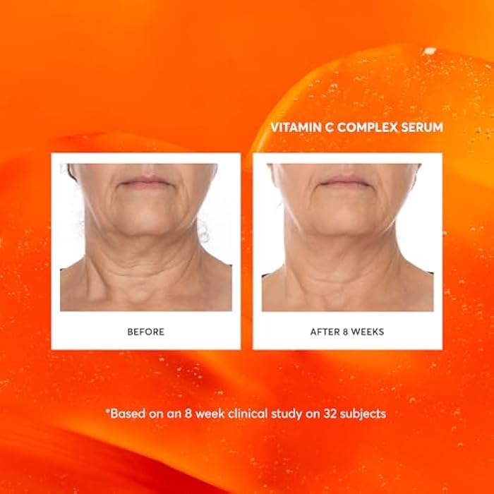 Naturium Vitamin C Complex Face Serum, Anti-Aging Facial Treatment with Hyaluronic Acid & Vitamin E, 1 oz - Image 3