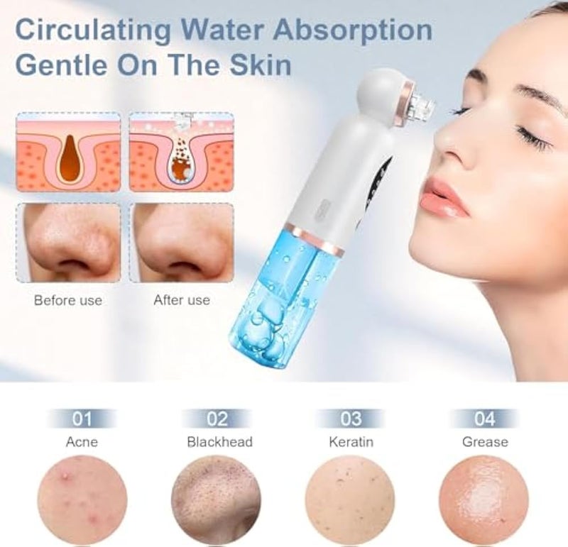 Electric Facial Liposuction Pore Cleaner Blackhead Remover USB Rechargeable with Mini Water Bubble System, Deep Pore Cleaner with 6 Modes and 6 Suction Heads, Comprehensive Skin Care for Men and Women - Image 3