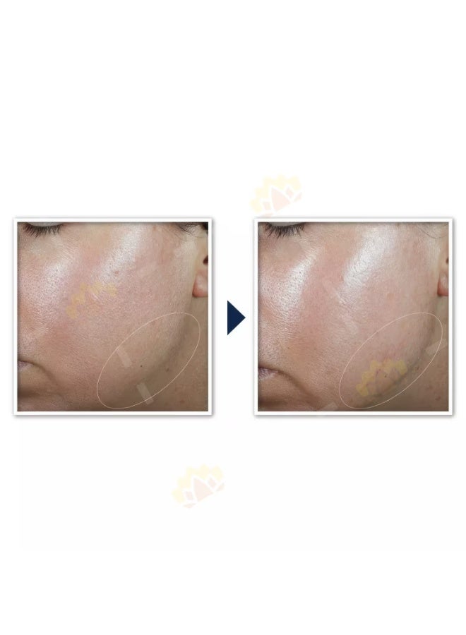 RoC Derm Correxion Contour Cream 50ml - Image 2