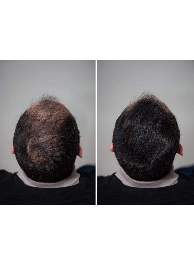 Levins King ® Hair Building Fiber, Hair concealer Refill Pack Use For Caboki, Toppik, Looks 21 etc.Black Color Total 25g+25g Gram Pack of 2 - Image 5