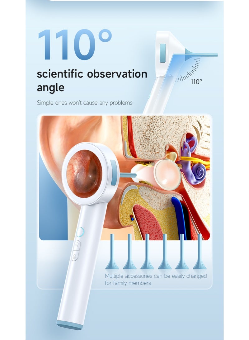 Digital otoscope camera with light – HD screen, supports photo and video recording and computer viewing, comes with 32GB card, ear infection detector, pocket-sized otoscope, with earwax removal tool, suitable for families, adults, children and pets. - Image 4
