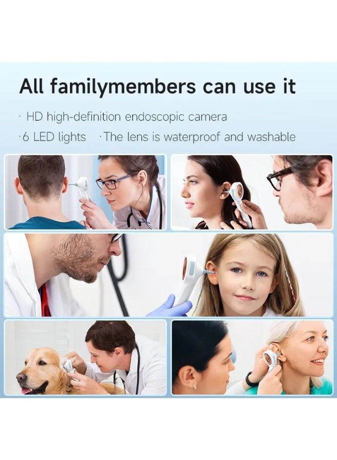 Digital otoscope camera with light – HD screen, supports photo and video recording and computer viewing, comes with 32GB card, ear infection detector, pocket-sized otoscope, with earwax removal tool, suitable for families, adults, children and pets. - Image 2