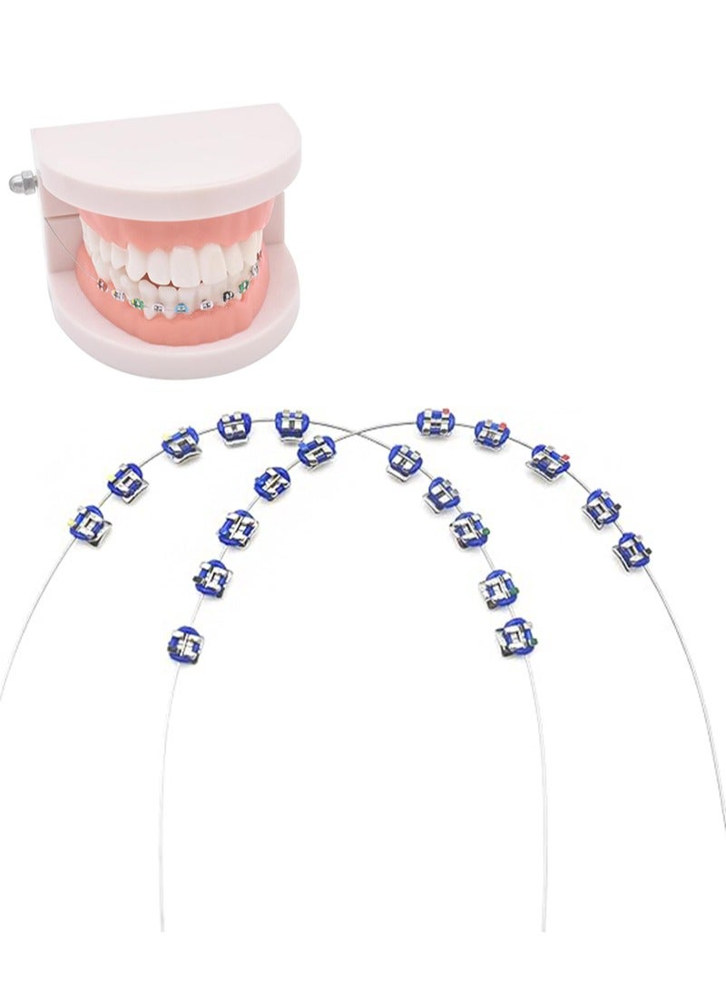 HaLunhi Temporary Tooth Decoration with Metal Wires，Metal Bracket and Orthodontic Ligature Ties，Practice Props for Dental Students（Blue）  - Image 1