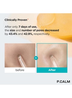 P.CALM Retinolagen Ampoule Pad 60 Patches Vegan Fragrancefree Pore Tightening Hydrogel Under Eye Patch With Retinol Vegan Collagen Bakuchiol Korean Skincare Crueltyfree  - Image 5