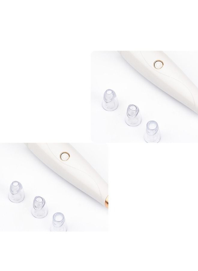 Blackhead Remover Pore Vacuum, Upgraded Facial Pore Cleaner, Electric Acne Comedone Whitehead Extractor Tool, 5 Probes, Blackhead Vacuum Kit for Women and Men