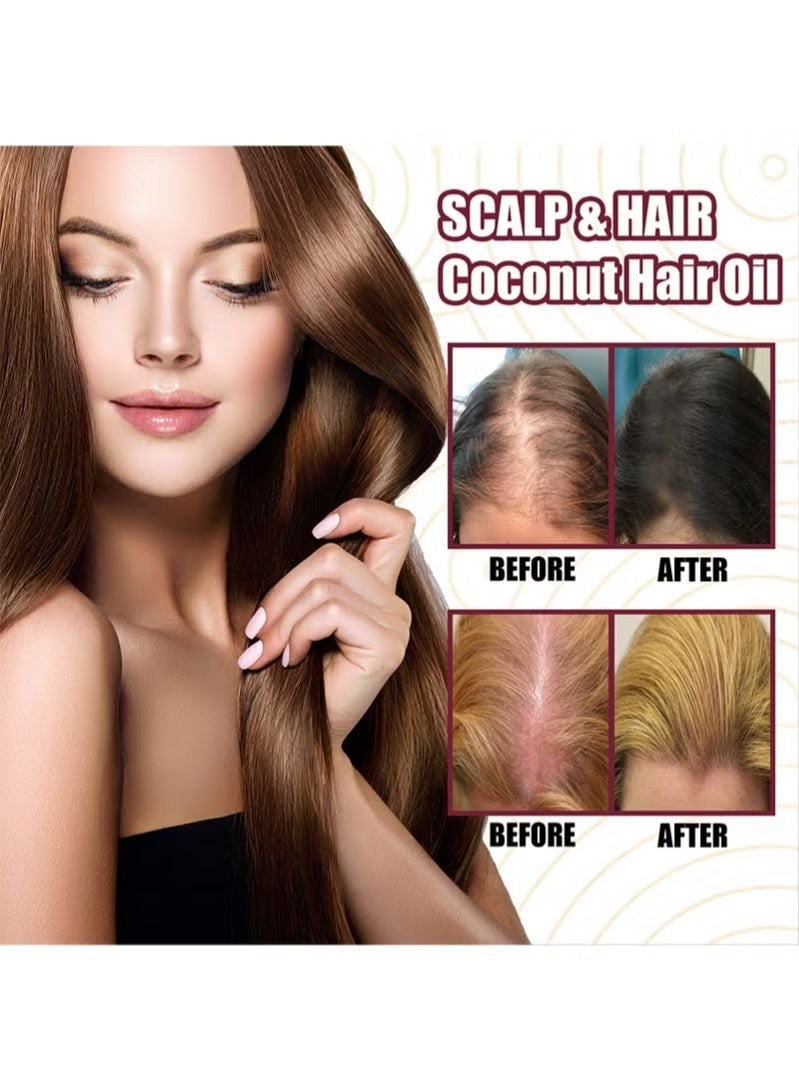 OUHOE 2Pcs Premium Red Onion Hair Oil，Onion Thickening Spray，Hair Oil with Onion Extract Onion Hair Growth Products for Men and Women Rapid Growth Anti-Hair Loss - Image 3