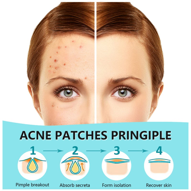 PICcircuit 180 Counts Pimple Patches for Face Hydrocolloid Acne Patches for face Invisible Zit Patches for Face Pimple Patch Acne Spot Treatment Patch Blemish Patches Cover Patches Stickers - Image 2