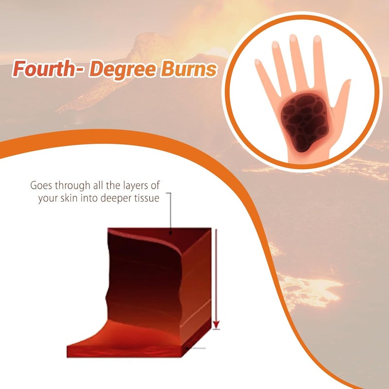 MedEduQuest Burn Wound Packing Trainer Burn Moulage Adhesive Skin Burn Wound Trainer for Wound Care Training Fourth Degree Burn Wound Training Model - Image 4
