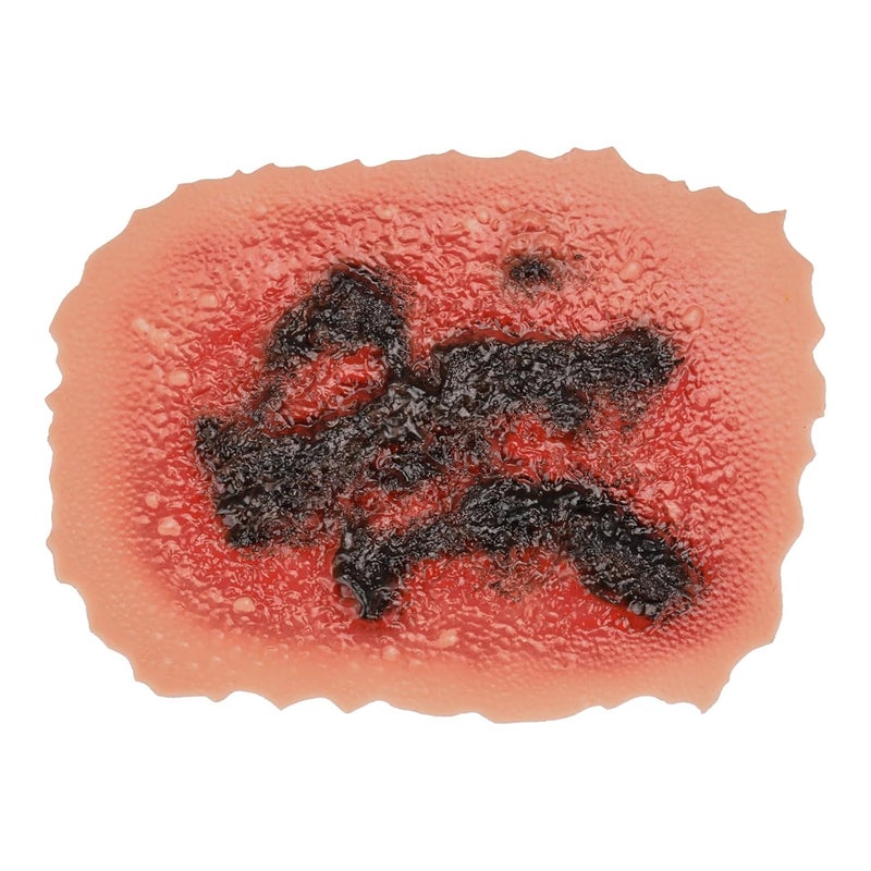 MedEduQuest Burn Wound Packing Trainer Burn Moulage Adhesive Skin Burn Wound Trainer for Wound Care Training Fourth Degree Burn Wound Training Model - Image 1