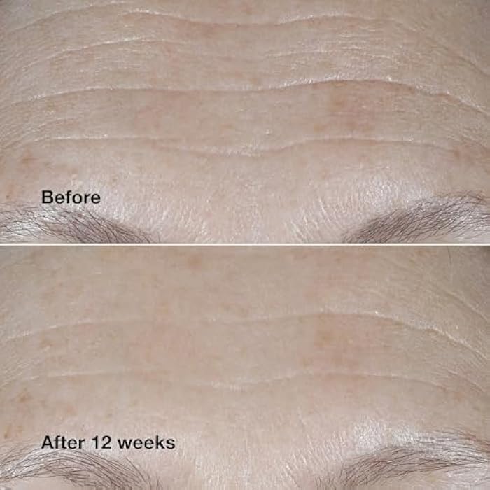 Clinique Smart Clinical Repair Broad Spectrum SPF 30 Wrinkle Correcting Cream with Peptides, Hyaluronic Acid + Glycerin | Protecting + Repairing - Image 5