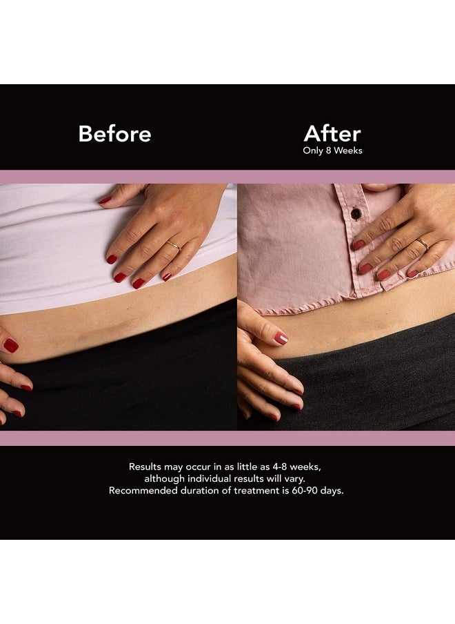 scaraway - Goodsense Scaraway Advanced Skincare Silicone Scar Sheets For Csections Reusable Sheets (1.5” X 7”) For Hypertrophic And Keloid Scars From Injury Burn Surgery And More 4 Sheets - Image 1