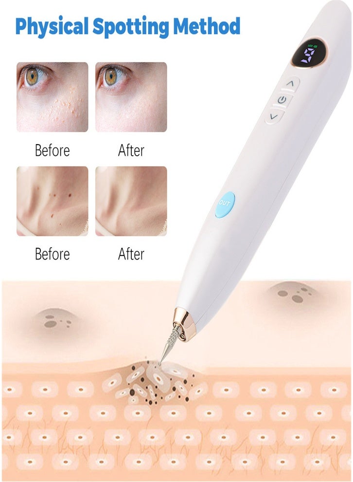Professional 9-Level LCD Screen Spot Removal Pen - USB Rechargeable Skin Tag and Wart Remover, Portable Spot Removal Pen with Replacement Needles, Suitable for Freckles and Tattoos (White) - Image 2