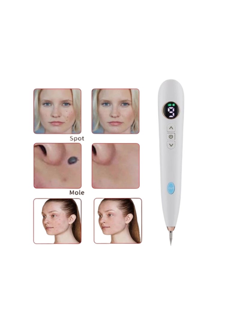 Professional 9-Level LCD Screen Spot Removal Pen - USB Rechargeable Skin Tag and Wart Remover, Portable Spot Removal Pen with Replacement Needles, Suitable for Freckles and Tattoos (White) - Image 1