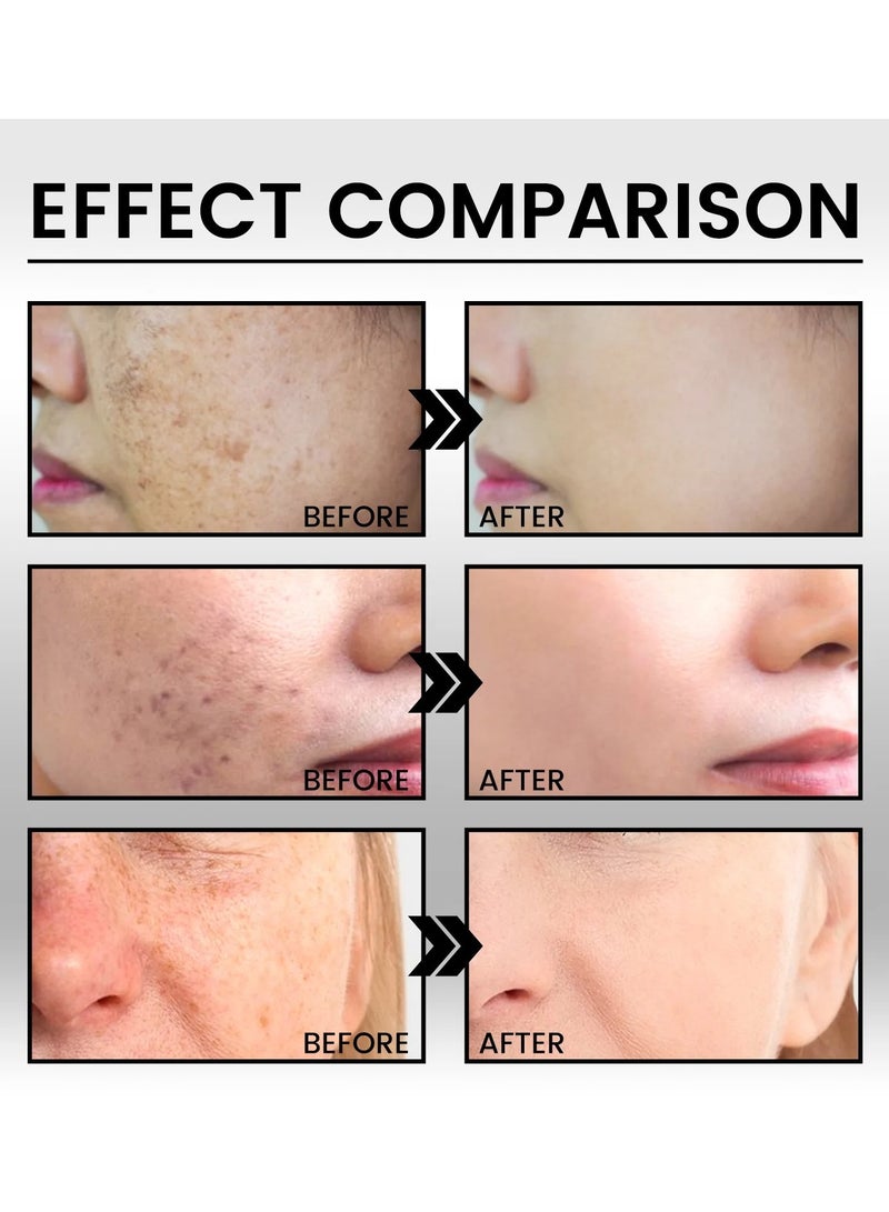 EELHOE Face Essence, Melanin Correcting Facial Serum, Dark Spot Correcting Glow Serum, Niacinamide Whitening Moisturizing Face Essence For Whitening Freckles, Chloasma And Melanin - Image 5