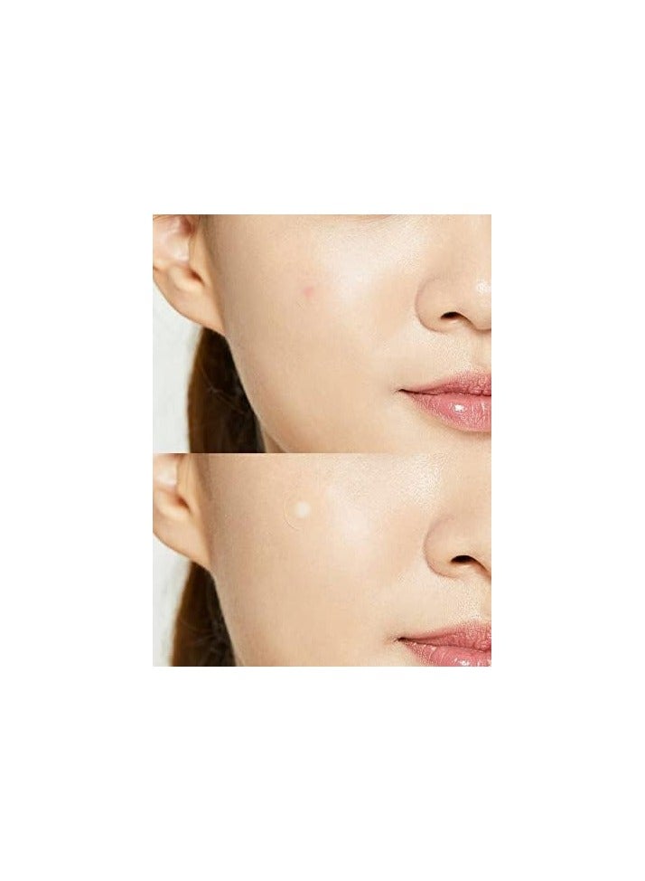 Cure aid 24 Pieces Hydrocolloid Spots - For Acne Treatment - Image 3