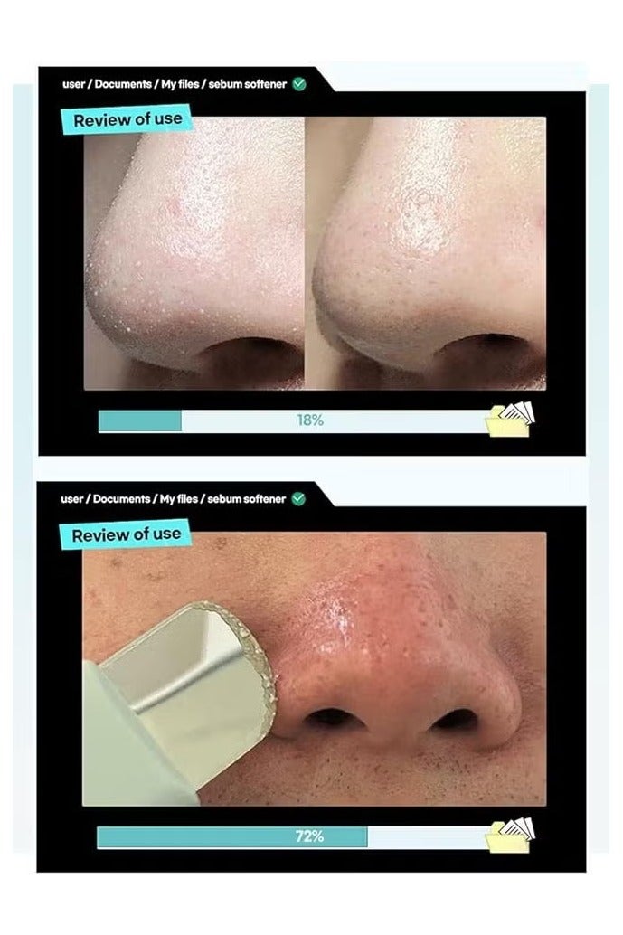 ilso Melting Sebum Softener, Pore Cleansing Solution, Melts Away Blackheads & Sebum - Image 5