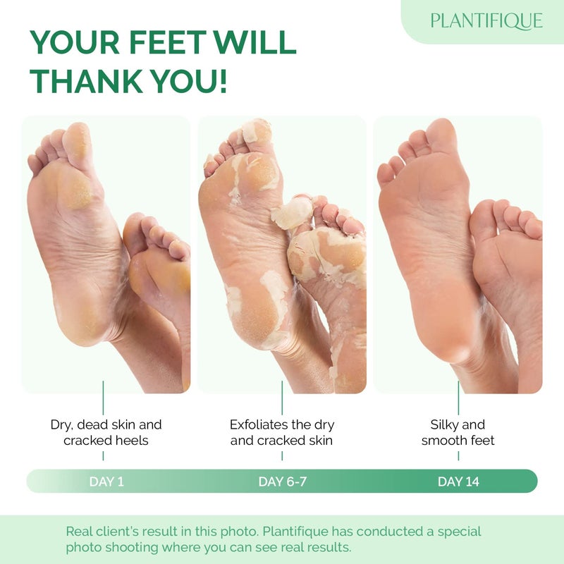 PLANTIFIQUE Foot Peeling Mask 2 Pack | Dermatologically Tested Repairs Heels & Removes Dry Dead Skin for Baby Soft Feet | Exfoliating Foot Peel Mask for Dry Cracked Feet | Lavender - Image 2