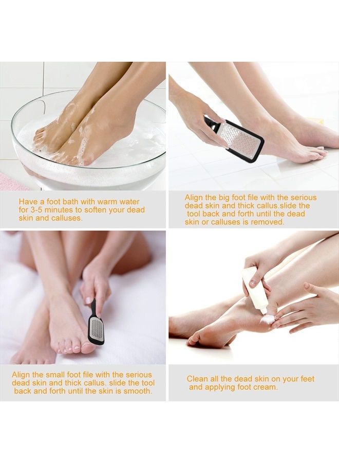 Aimiduo Foot File Callus Remover,Colossal Foot Rasp and Professional Foot Scrubber Pedicure Kit to Remove Hard Skin for Wet and Dry Feet,Surgical Grade Stainless Steel File (black and silvery)  - Image 5