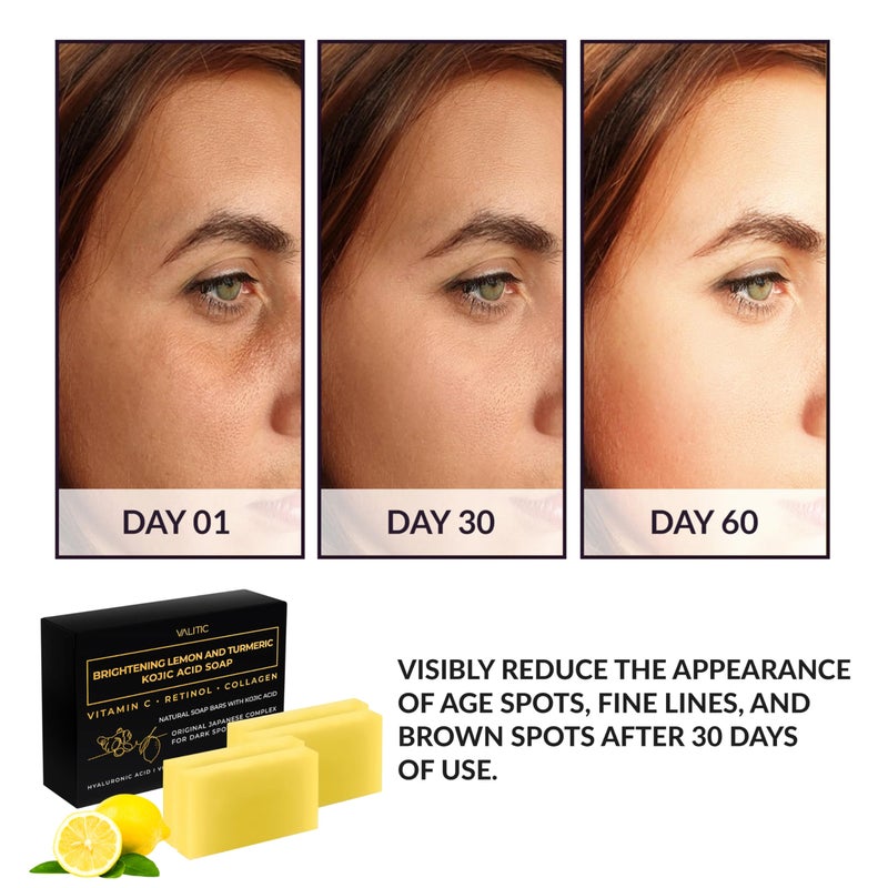 VALITIC Brightening Lemon & Turmeric Kojic Acid Soap with Vitamin C, Retinol, Collagen - Original Japanese Complex Infused with Hyaluronic Acid, Vitamin E, Shea Butter, Castile Olive Oil (4 Pack) - Image 3