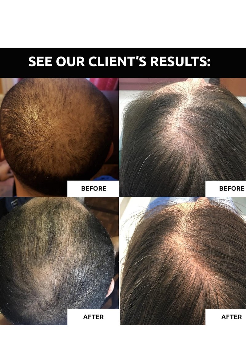 DS LABORATORIES - DS Laboratories Revita Shampoo - Hair Growth Shampoo, DHT Blocker, Biotin Formula, for Hair Thickening and Regrowth Treatment for Women and Men - Image 1