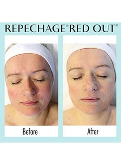 Repechage Hydra 4 Red Out Serum With Microsilver + Quercetin Skin Calming And Soothing Relief Face Serum 1 Fl Oz  - Image 2