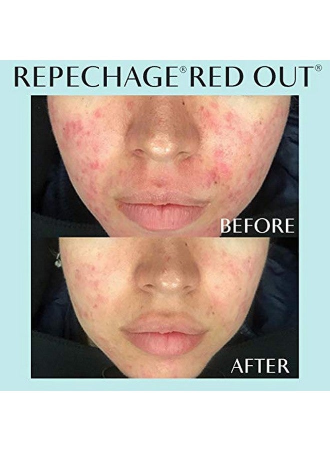 Repechage Hydra 4 Red Out Serum With Microsilver + Quercetin Skin Calming And Soothing Relief Face Serum 1 Fl Oz - Image 3