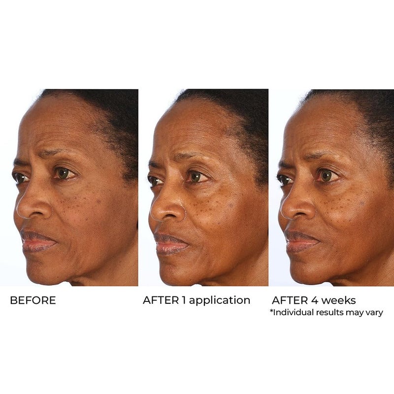 nassif md NassifMD Radiance Booster Vitamins C for Face, Brightening serum Dark Spot Remover, Vitamin C with Omega-3 and Squalene Oil - Image 5