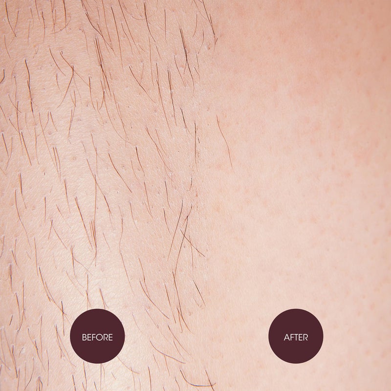 Nad's Waxing Dots - Strawberries & Cream Hard Wax Beads - Microwaveable No-Strip Formula For Women - Image 5