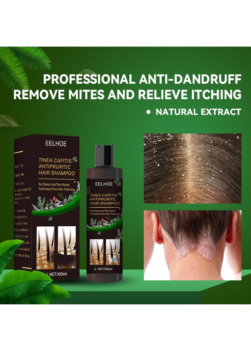 EELHOE Tinea Capitis Antipruritic Hair Shampoo, Anti-Dandruff Shampoo, Shampoo For Scalp Prone To Folliculitis, Dermatitis, Dandruff, Mites, Itchy And Flaky Scalp, Treats Dandruff And Seborrheic Dermatitis - Image 2