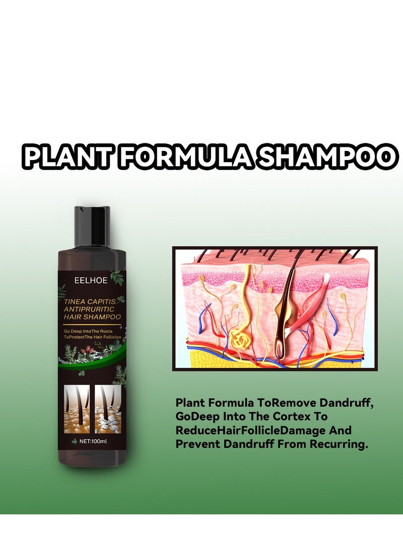 EELHOE Tinea Capitis Antipruritic Hair Shampoo, Anti-Dandruff Shampoo, Shampoo For Scalp Prone To Folliculitis, Dermatitis, Dandruff, Mites, Itchy And Flaky Scalp, Treats Dandruff And Seborrheic Dermatitis - Image 4