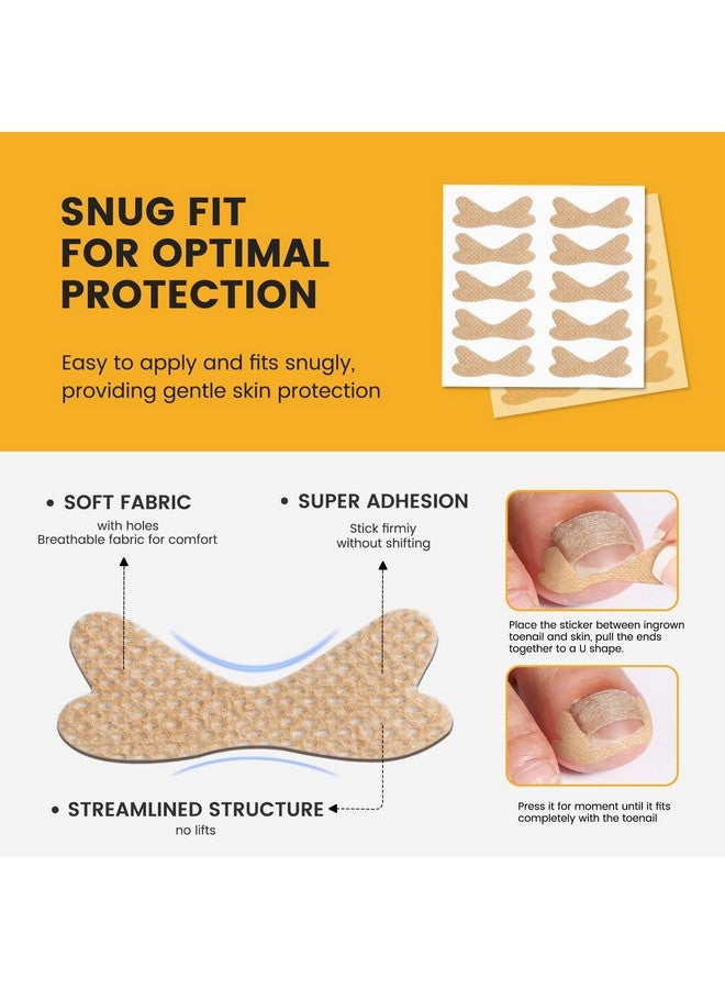BEZOX 60Pcs Breathable Ingrown Toenail Corrector Patches And 50Pcs Ingrown Toenail Stickers - Professional Ingrown Toe Nail Treatment Tape For Pain Relief And Correction - Image 5