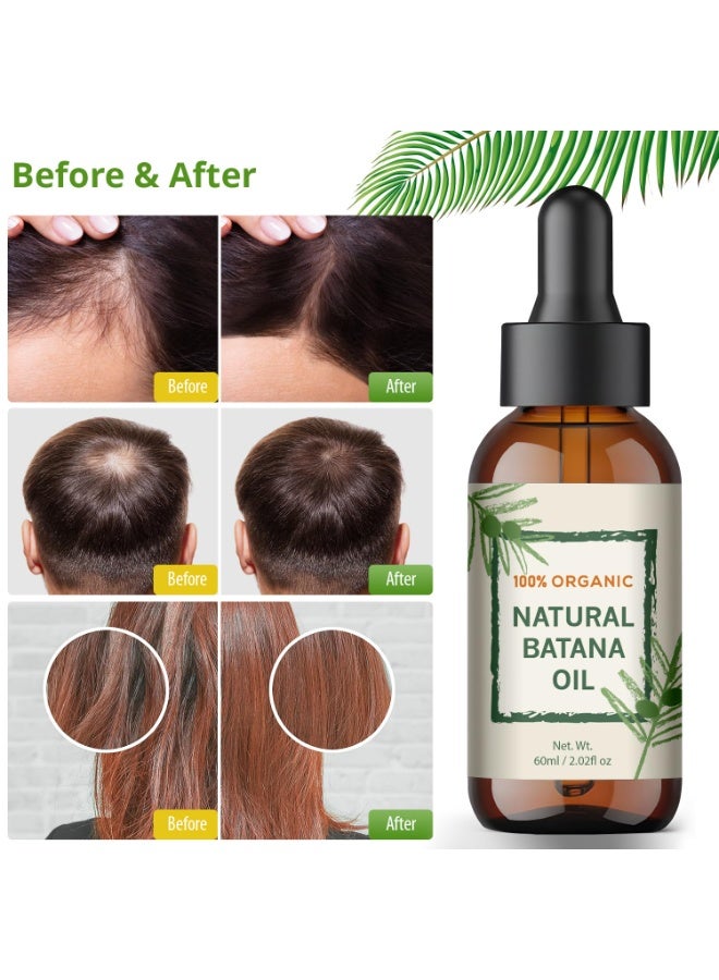 YBW Batana Oil for Hair Growth â€“ Dr Sebi Honduran Hair oil for Thicker, Stronger Hair, Repairs Split Ends & Dry Scalp, Supports Hair Regrowth for Men & Women, Natural Hair Moisturizer (2.02 fl oz) - Image 2