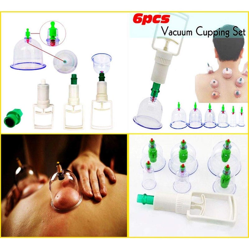 RETSPHIX HIJAMA CUPPING KIT SET 6PCS Vacuum Cupping Set Health Care Portable Professional Massager Body Relaxation Massage Therapy Kit, White - Image 3