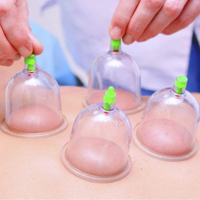 RETSPHIX HIJAMA CUPPING KIT SET 6PCS Vacuum Cupping Set Health Care Portable Professional Massager Body Relaxation Massage Therapy Kit, White - Image 4